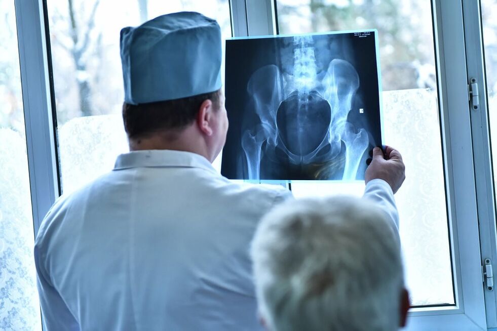 Medikuak artrosia duen aldaka artikulazio baten argazkia ikusten du